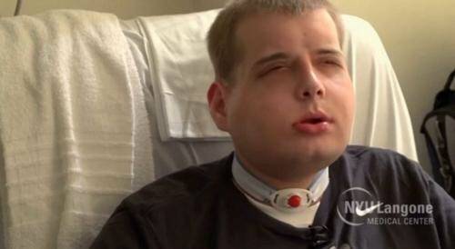 Injured firefighter undergoes the world’s most extensive face transplant