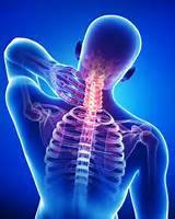 New Laser Treatment Helps Neck Pain and Headaches