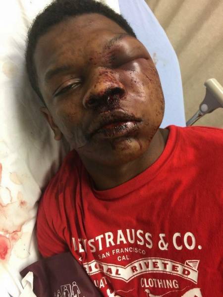 GRAPHIC IMAGES:   Police: Teen resisted arrest, led to use of physical force - TROY POLICE DEPARTMENT