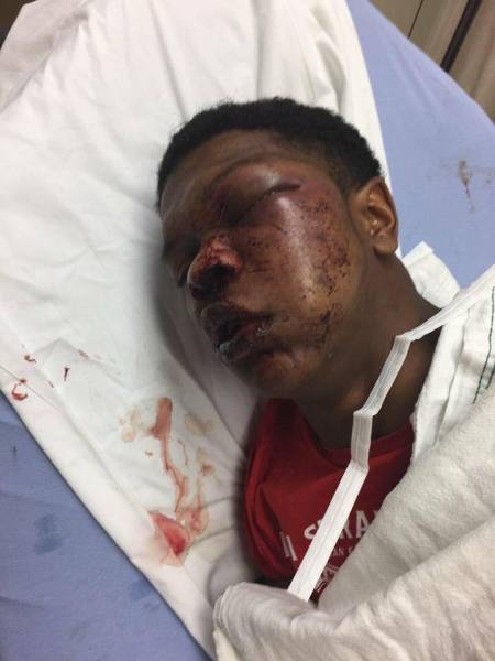 GRAPHIC IMAGES:   Police: Teen resisted arrest, led to use of physical force - TROY POLICE DEPARTMENT