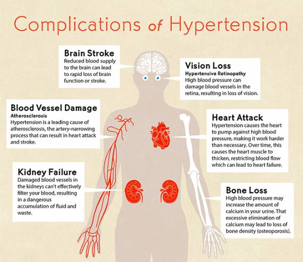 Alabama Clinics - Do You Have Hypertension?