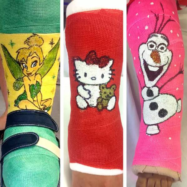 California Hospital Tech Brightens Kids’ Casts with Amazing Artwork